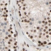 Anti-CHAMP1 antibody produced in rabbit Prestige Antibodies® Powered by Atlas Antibodies, affinity isolated antibody, buffered aqueous glycerol solution