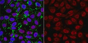 Anti-SKP1 Antibody, clone 3F3.1 clone 3F3.1, from mouse