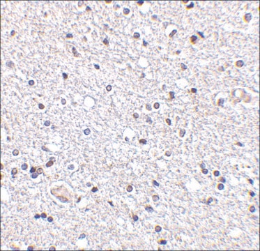 Anti-TSLP (ab2) antibody produced in rabbit affinity isolated antibody, buffered aqueous solution