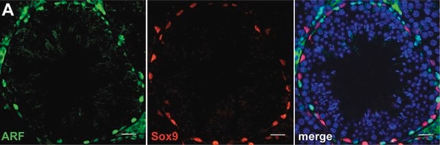 Anti-Sox9 Antibody Chemicon&#174;, from rabbit