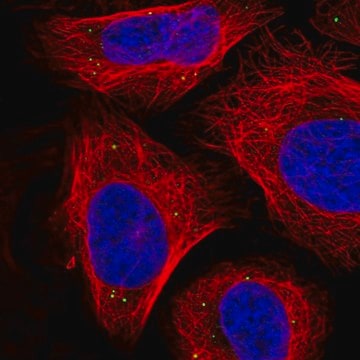 抗-SEMA3A 兔抗 affinity isolated antibody