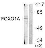 Anti-FOXO1A antibody produced in rabbit affinity isolated antibody