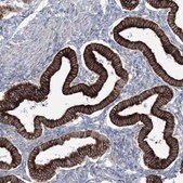 Anti-RCN1 antibody produced in rabbit Prestige Antibodies&#174; Powered by Atlas Antibodies, affinity isolated antibody, buffered aqueous glycerol solution