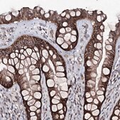 Anti-SEMA4G antibody produced in rabbit Prestige Antibodies&#174; Powered by Atlas Antibodies, affinity isolated antibody, buffered aqueous glycerol solution
