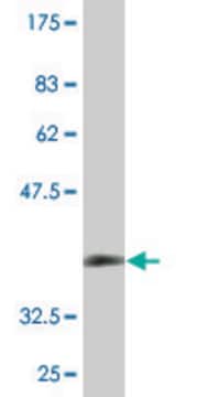 Monoclonal Anti-ZDHHC13 antibody produced in mouse clone 2A4, purified immunoglobulin, buffered aqueous solution