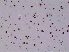 Anti-5-Hydroxymethylcytosine antibody, Rabbit monoclonal recombinant, expressed in HEK 293 cells, clone RM236, purified immunoglobulin