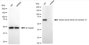 KD-Validated Anti SLC25A12 Antibody, clone 24GB2340, Rabbit Monoclonal clone 24GB2340, recombinant rabbit monoclonal, expressed in HEK293 cells