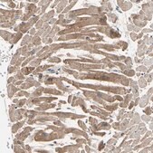 Anti-MAP3K10 antibody produced in rabbit Prestige Antibodies&#174; Powered by Atlas Antibodies, affinity isolated antibody, buffered aqueous glycerol solution