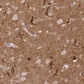 Anti-SLC9A6 antibody produced in rabbit Prestige Antibodies&#174; Powered by Atlas Antibodies, affinity isolated antibody, buffered aqueous glycerol solution