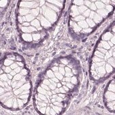 Anti-KRT82 antibody produced in rabbit Prestige Antibodies&#174; Powered by Atlas Antibodies, affinity isolated antibody, buffered aqueous glycerol solution