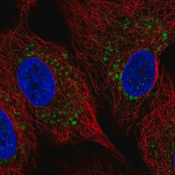 Anti-ZDHHC11B antibody produced in rabbit Prestige Antibodies&#174; Powered by Atlas Antibodies, affinity isolated antibody