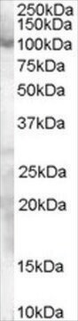 Anti-SP1 antibody produced in goat affinity isolated antibody, buffered aqueous solution