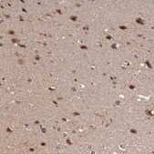 Anti-RGS6 antibody produced in rabbit Prestige Antibodies&#174; Powered by Atlas Antibodies, affinity isolated antibody, buffered aqueous glycerol solution