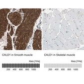 Anti-CALD1 antibody produced in rabbit Ab1, Prestige Antibodies&#174; Powered by Atlas Antibodies, affinity isolated antibody, buffered aqueous glycerol solution