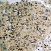Anti-phospho-IKK-&#946; (pTyr188) antibody produced in rabbit affinity isolated antibody