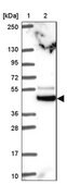 Anti-TRIM44 antibody produced in rabbit Prestige Antibodies&#174; Powered by Atlas Antibodies, affinity isolated antibody, buffered aqueous glycerol solution