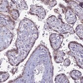 Anti-FAM3C antibody produced in rabbit Prestige Antibodies&#174; Powered by Atlas Antibodies, affinity isolated antibody, buffered aqueous glycerol solution
