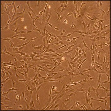 Human Chondrocytes - Osteoarthritis: HC-OA, adult