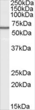 Anti-B7-H4 antibody produced in goat affinity isolated antibody, buffered aqueous solution