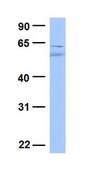 Anti-FOXO3 antibody produced in rabbit affinity isolated antibody