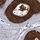 Anti-MTHFR antibody produced in rabbit Prestige Antibodies&#174; Powered by Atlas Antibodies, affinity isolated antibody, buffered aqueous glycerol solution