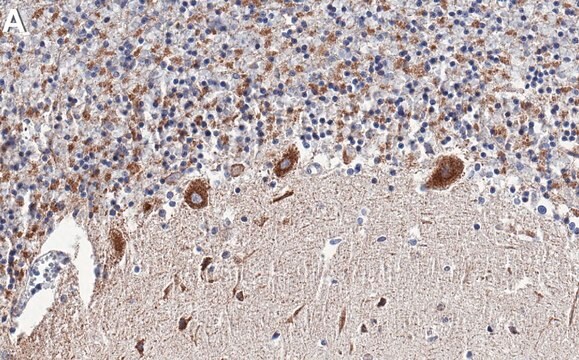 Anti-BTG2 Antibody, clone 1G17 ZooMAb&#174; Rabbit Monoclonal recombinant, expressed in HEK 293 cells