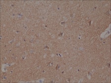 Anti-Spastin antibody, Rabbit monoclonal recombinant, expressed in HEK 293 cells, clone RM346, purified immunoglobulin
