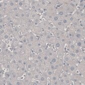 Monoclonal Anti-PDCD1 antibody produced in mouse Prestige Antibodies® Powered by Atlas Antibodies, clone CL3624, purified immunoglobulin, buffered aqueous glycerol solution