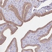 Anti-YAP1 antibody produced in rabbit Prestige Antibodies&#174; Powered by Atlas Antibodies, affinity isolated antibody, buffered aqueous glycerol solution