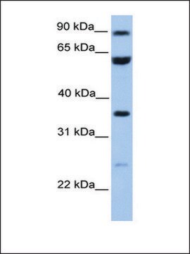 Anti-CCDC7 antibody produced in rabbit affinity isolated antibody