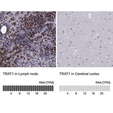 Anti-TRAT1 antibody produced in rabbit Prestige Antibodies&#174; Powered by Atlas Antibodies, affinity isolated antibody, buffered aqueous glycerol solution
