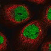 Anti-NYAP2 antibody produced in rabbit Prestige Antibodies® Powered by Atlas Antibodies, affinity isolated antibody, buffered aqueous glycerol solution