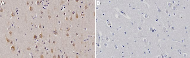 Anti-TAOK2 Antibody, clone 1N9 ZooMAb&#174; Rabbit Monoclonal recombinant, expressed in HEK 293 cells