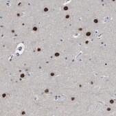 Anti-SLC29A2 antibody produced in rabbit Prestige Antibodies&#174; Powered by Atlas Antibodies, affinity isolated antibody, buffered aqueous glycerol solution