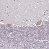 Anti-RC3H2 antibody produced in rabbit Prestige Antibodies&#174; Powered by Atlas Antibodies, affinity isolated antibody, buffered aqueous glycerol solution