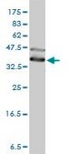 Monoclonal Anti-DNAJA4 antibody produced in mouse clone 4B4-1F2, purified immunoglobulin, buffered aqueous solution