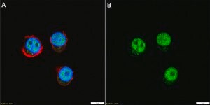 Anti-Bcl-11B Antibody, clone 1G14 ZooMAb&#174; Rabbit Monoclonal recombinant, expressed in HEK 293 cells
