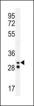 ANTI-NEUTROPHIL ELASTASE(N-TERMINAL) antibody produced in rabbit affinity isolated antibody, buffered aqueous solution