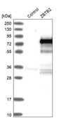 Anti-ZBTB2 antibody produced in rabbit Prestige Antibodies&#174; Powered by Atlas Antibodies, affinity isolated antibody, buffered aqueous glycerol solution, Ab4