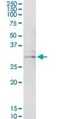 Anti-USE1 antibody produced in rabbit purified immunoglobulin, buffered aqueous solution
