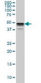 Monoclonal Anti-MKNK1 antibody produced in mouse clone 3E1, purified immunoglobulin, buffered aqueous solution