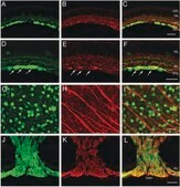 Anti-Neurofilament L Antibody serum, Chemicon&#174;