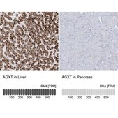 Anti-AGXT antibody produced in rabbit Prestige Antibodies® Powered by Atlas Antibodies, affinity isolated antibody, buffered aqueous glycerol solution