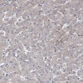Anti-ABCF2 antibody produced in rabbit Prestige Antibodies&#174; Powered by Atlas Antibodies, affinity isolated antibody, buffered aqueous glycerol solution, Ab1