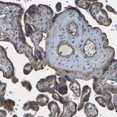 Anti-SLC4A2 antibody produced in rabbit Prestige Antibodies&#174; Powered by Atlas Antibodies, affinity isolated antibody, buffered aqueous glycerol solution