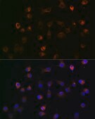 Anti-γ-Catenin Antibody, clone 9O2K8, Rabbit Monoclonal