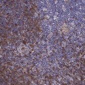 Anti-DOK3 Prestige Antibodies&#174; Powered by Atlas Antibodies, affinity isolated antibody