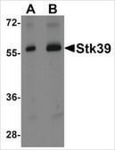 Anti-STK39 (ab2) antibody produced in rabbit affinity isolated antibody, buffered aqueous solution