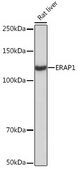 Anti-ERAP1 Antibody, clone 6V8C0, Rabbit Monoclonal