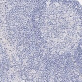 Anti-TRIM2 antibody produced in rabbit Prestige Antibodies&#174; Powered by Atlas Antibodies, affinity isolated antibody, buffered aqueous glycerol solution